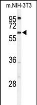 TMEM108 Antibody (C-term)
