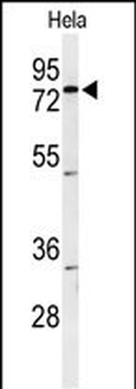 CLPTM1 Antibody (Center)