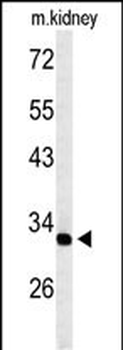 TMUB2 Antibody (Center)