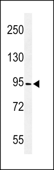 CF097 Antibody (C-term)