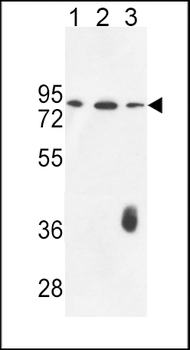 F12 Antibody (N-term)