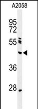 NEIL1 Antibody (Center)