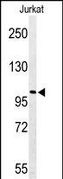 PKHH2 Antibody (C-term)