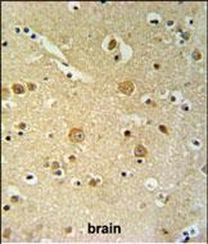 PKHH2 Antibody (C-term)