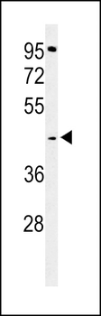 GPSN2 Antibody (C-term)