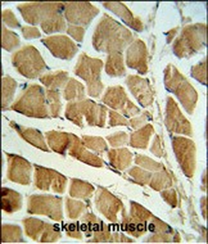 CAPN3 Antibody (C-term)