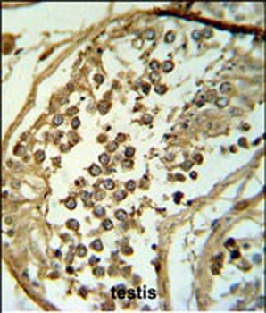 C19orf18 Antibody (Center)