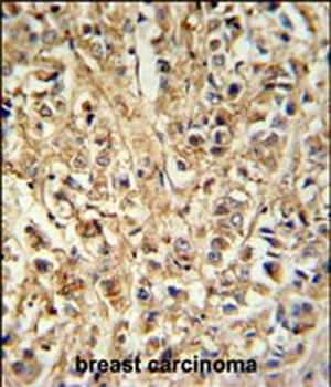 DDX6 Antibody (Center)