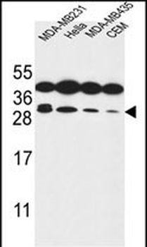 STX10 Antibody (N-term)