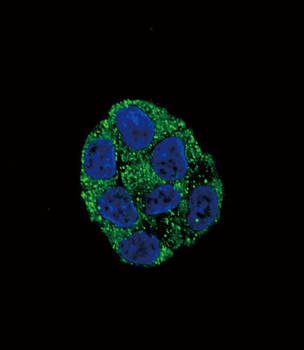PLA2G6 Antibody (Center)