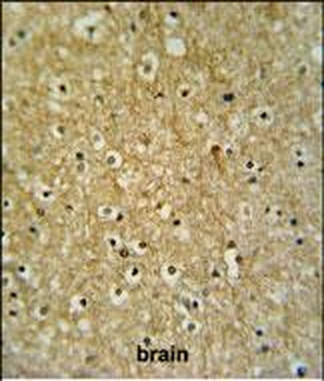 CIRH1A Antibody (N-term)