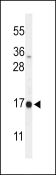 DAZAP2 Antibody (C-term)