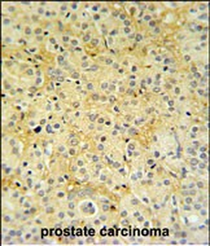 DAZAP2 Antibody (C-term)