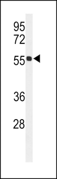 HIAT1 Antibody (C-term)