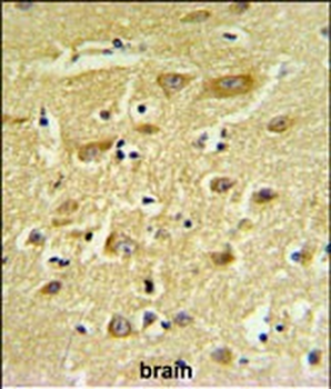 HIAT1 Antibody (C-term)