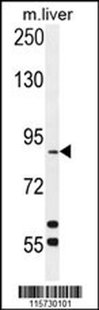 dik Antibody (Center)
