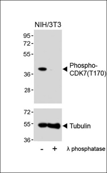 CDK7 (phospho-T170) antibody