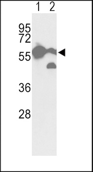 PKM antibody