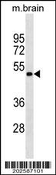 GNAS Antibody (Ascites)
