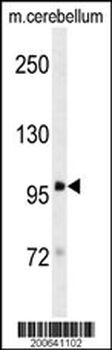 DLG4 Antibody (C-term) (Rat) (Ascites)