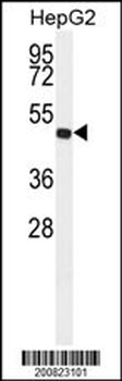 ALDH3A2 Antibody (Ascites)