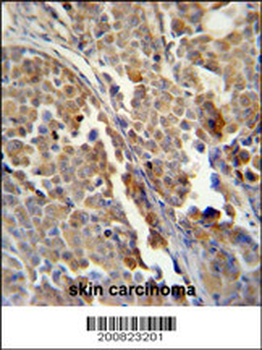ALDH3A2 Antibody (Ascites)