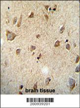 RET Antibody (Ascites)