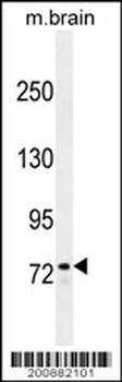 ZFP37 antibody (Ascites)