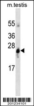 GSTA1 Antibody (ascites)