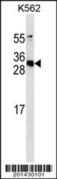 APCS Antibody (Ascites)