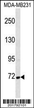 Cortactin Antibody(Ascites)