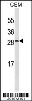 CRP Antibody (Ascites)