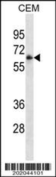 FCGR3A Antibody (Ascites)