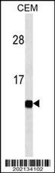 B2M Antibody (Ascites)