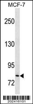 CTNNB1 Antibody (Ascites)