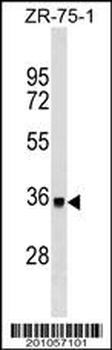 DYT1 Antibody
