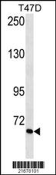 VTN Antibody(Ascites)