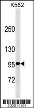 TNFRSF8/CD30 Antibody (Center) (Ascites)