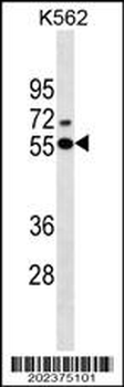 ESR2 Antibody (Center) (Ascites)