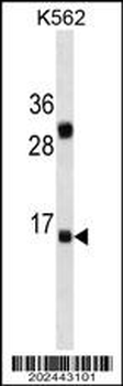 IL2 Antibody (Center) (Ascites)