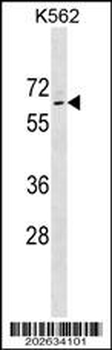 TP63 Antibody (Ascites)