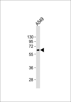 PODXL Antibody (C-term) (Ascites)