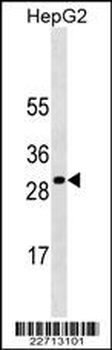 SOCS3 Antibody (Ascites)