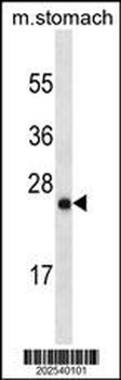 LYPD6B Antibody (Center) (Ascites)