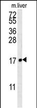 FAM158A Antibody (C-term)
