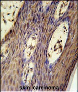 FAM158A Antibody (C-term)