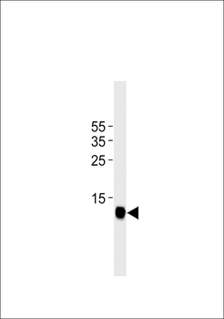 FAPB3 Antibody(Ascites)