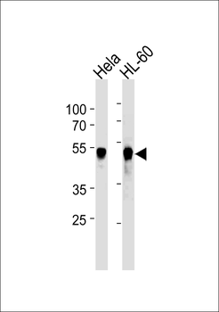 VRK1 Antibody (Center)(Ascites)