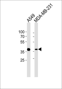 ANXA1 Antibody (Ab-21)