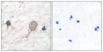 NSE Antibody